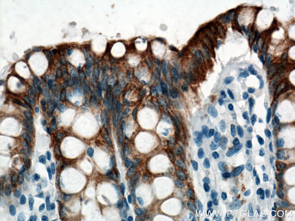 IHC staining of human colon using 17329-1-AP