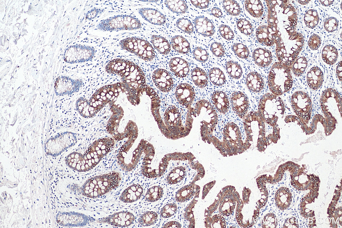 Immunohistochemistry (IHC) staining of human colon tissue using Cytokeratin 20 Polyclonal antibody (17329-1-AP)