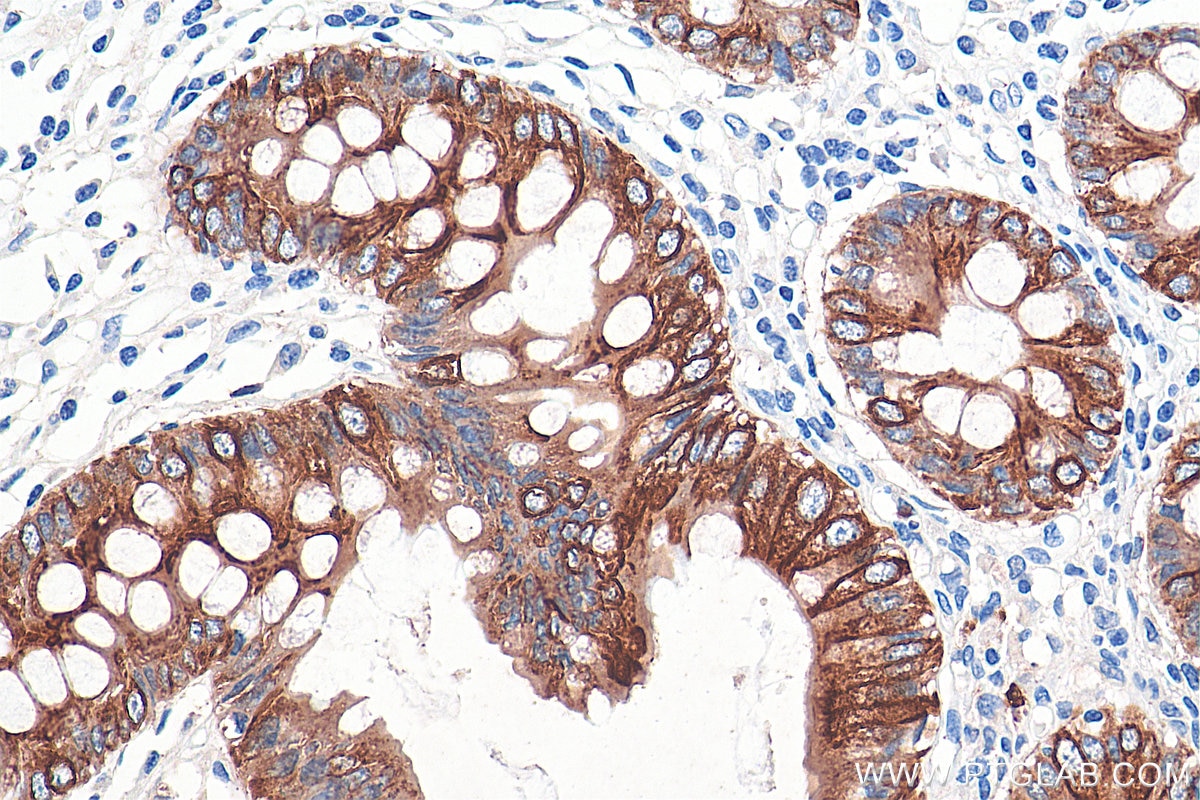 Immunohistochemistry (IHC) staining of human colon tissue using Cytokeratin 20 Polyclonal antibody (17329-1-AP)