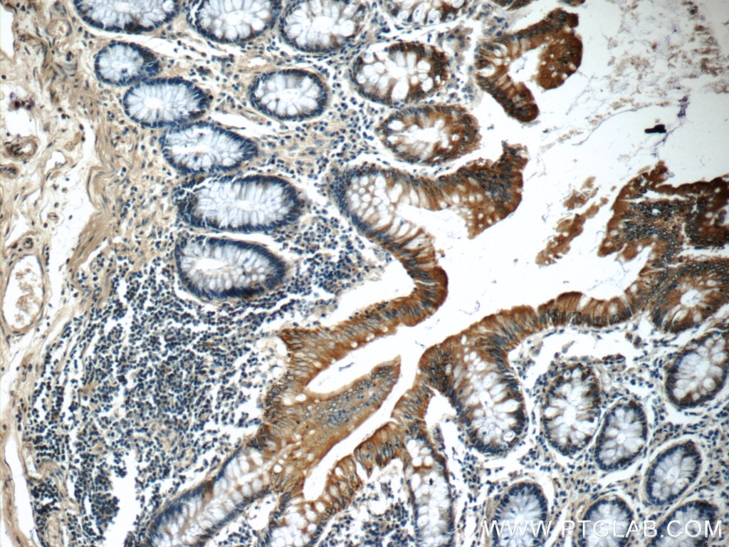 Cytokeratin 20 Polyclonal antibody