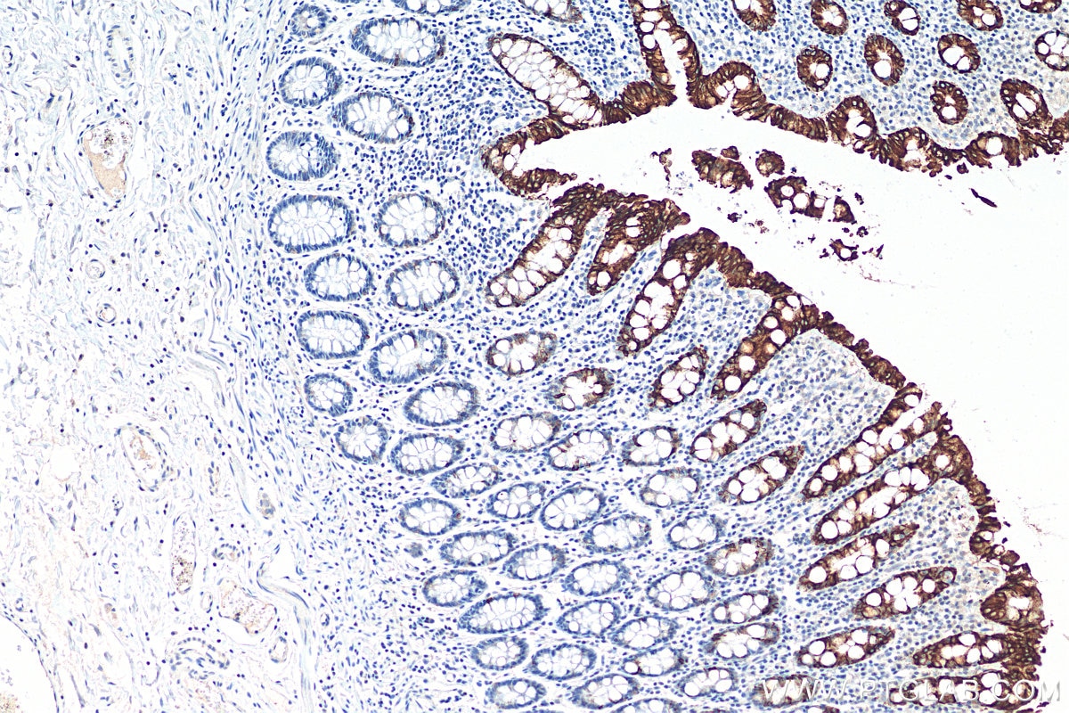 Immunohistochemistry (IHC) staining of human colon tissue using Cytokeratin 20 Polyclonal antibody (17329-1-AP)