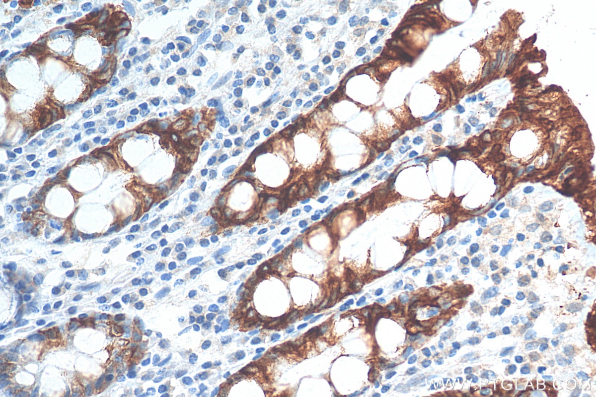 Immunohistochemistry (IHC) staining of human colon tissue using Cytokeratin 20 Polyclonal antibody (17329-1-AP)