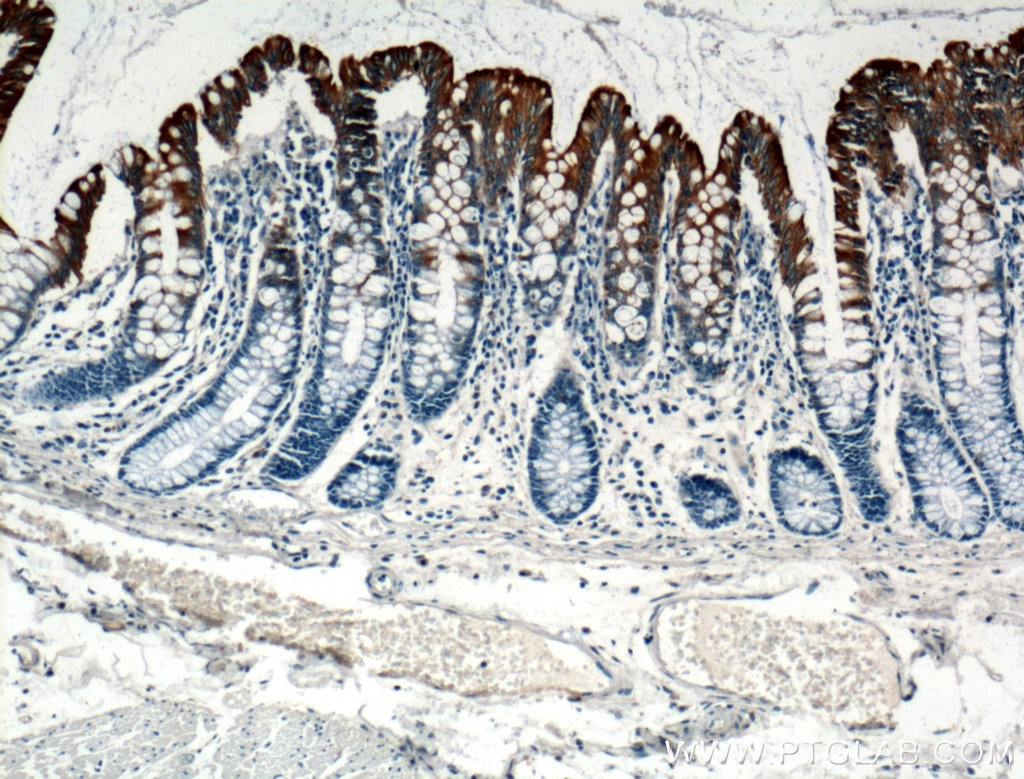 Cytokeratin 20 Polyclonal antibody