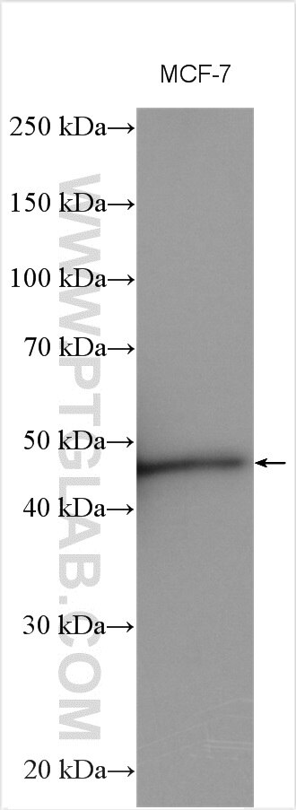 Western Blot (WB) analysis of various lysates using Cytokeratin 20 Polyclonal antibody (17329-1-AP)