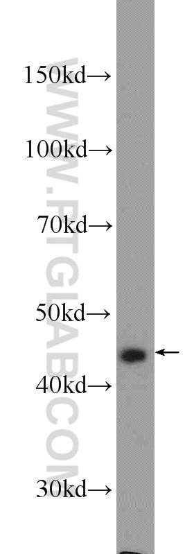 Western Blot (WB) analysis of HeLa cells using Cytokeratin 20 Polyclonal antibody (17329-1-AP)