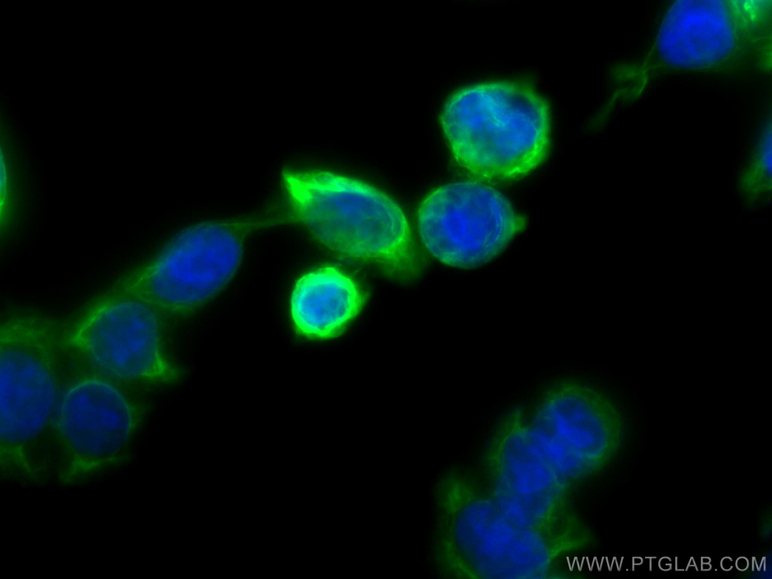 Immunofluorescence (IF) / fluorescent staining of HT-29 cells using Cytokeratin 20 Monoclonal antibody (60183-1-Ig)