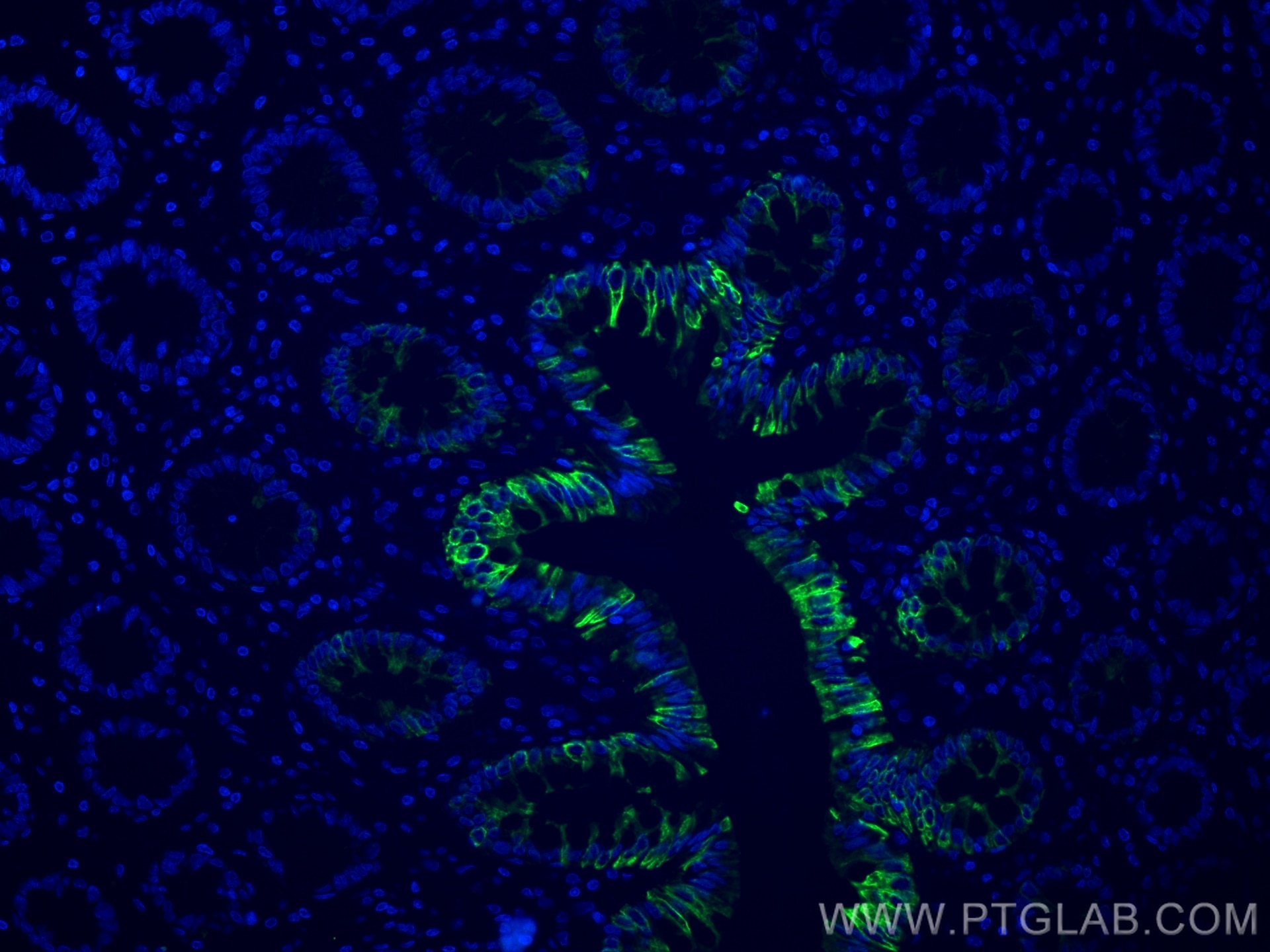 Immunofluorescence (IF) / fluorescent staining of human colon tissue using Cytokeratin 20 Monoclonal antibody (60183-1-Ig)