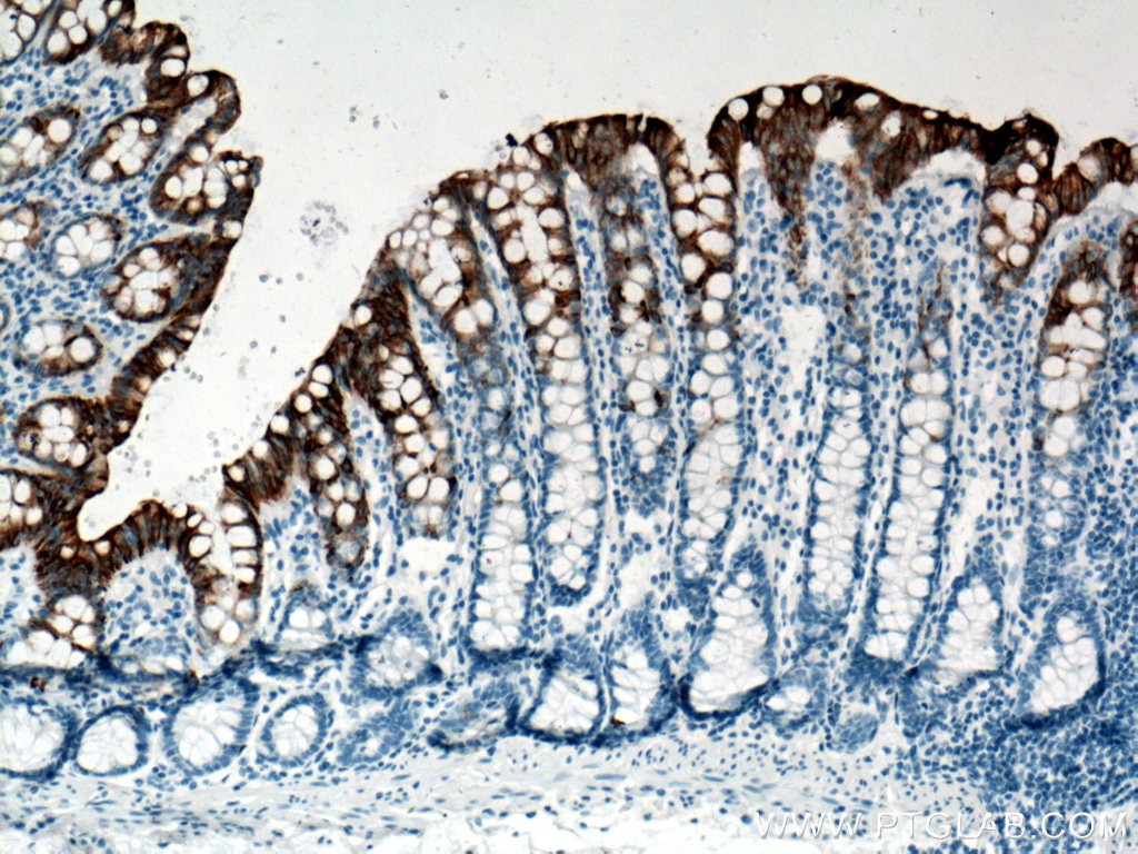 Immunohistochemistry (IHC) staining of human colon tissue using Cytokeratin 20 Monoclonal antibody (60183-1-Ig)