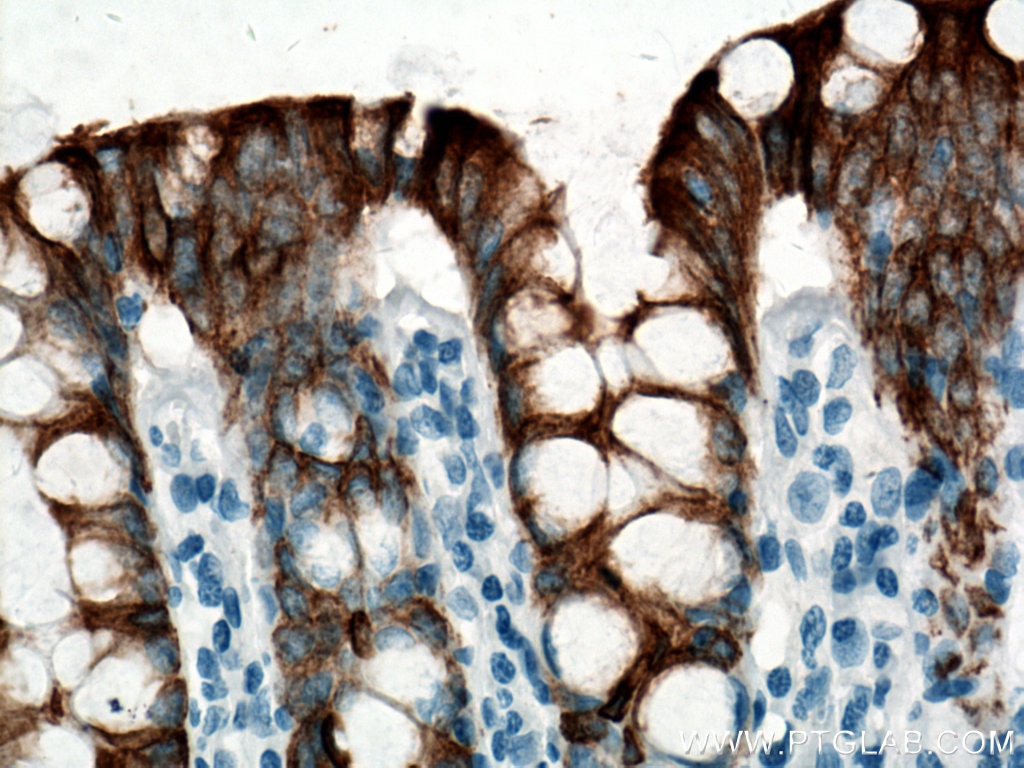 Immunohistochemistry (IHC) staining of human colon tissue using Cytokeratin 20 Monoclonal antibody (60183-1-Ig)