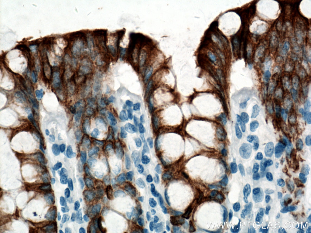 IHC staining of human colon using 60183-1-Ig