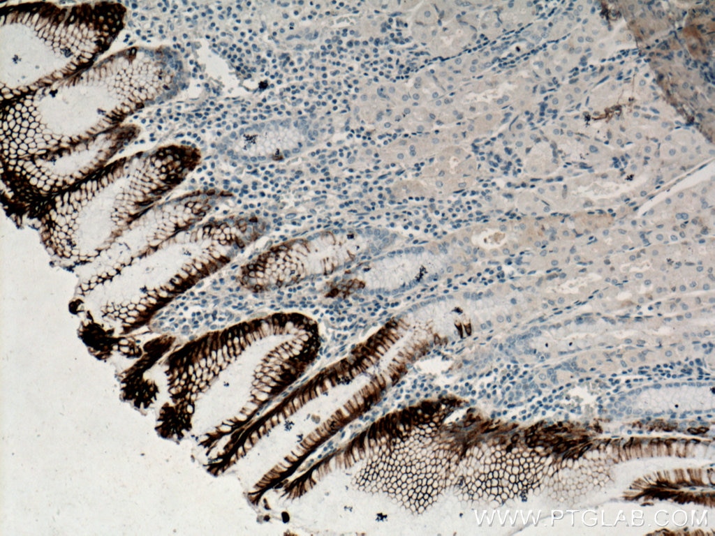 Immunohistochemistry (IHC) staining of human stomach tissue using Cytokeratin 20 Monoclonal antibody (60183-1-Ig)