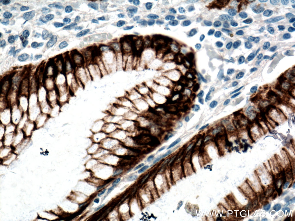 Immunohistochemistry (IHC) staining of human stomach tissue using Cytokeratin 20 Monoclonal antibody (60183-1-Ig)