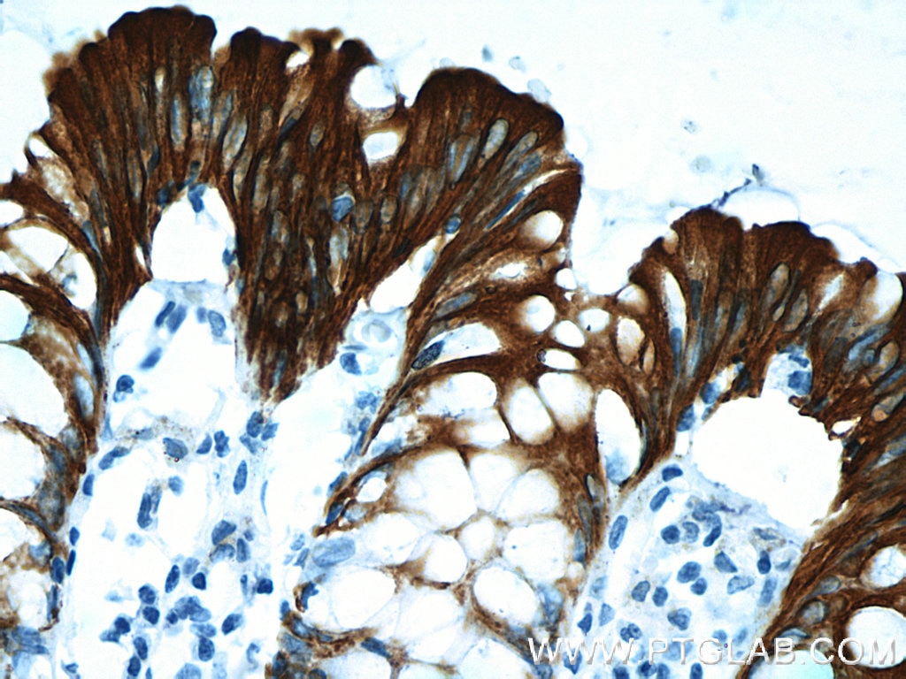 Cytokeratin 20 Monoclonal antibody