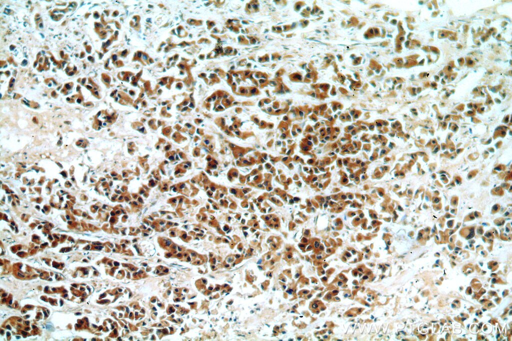 Cytokeratin 20