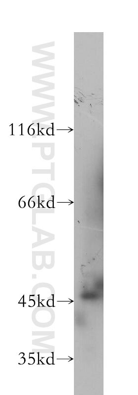 Western Blot (WB) analysis of COLO 320 cells using Cytokeratin 20 Monoclonal antibody (60183-1-Ig)