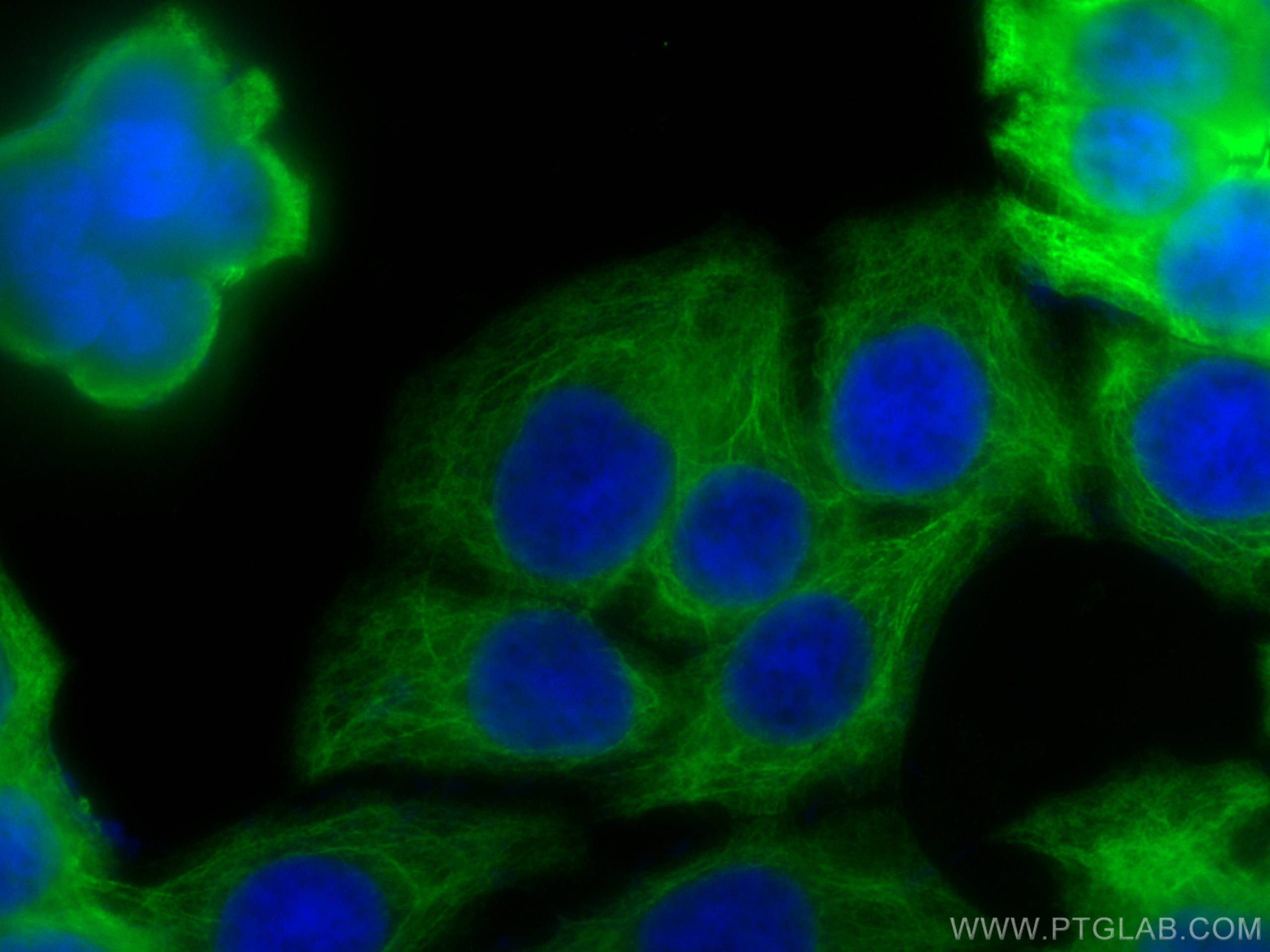 Immunofluorescence (IF) / fluorescent staining of HT-29 cells using Cytokeratin 20 Recombinant antibody (82428-1-RR)