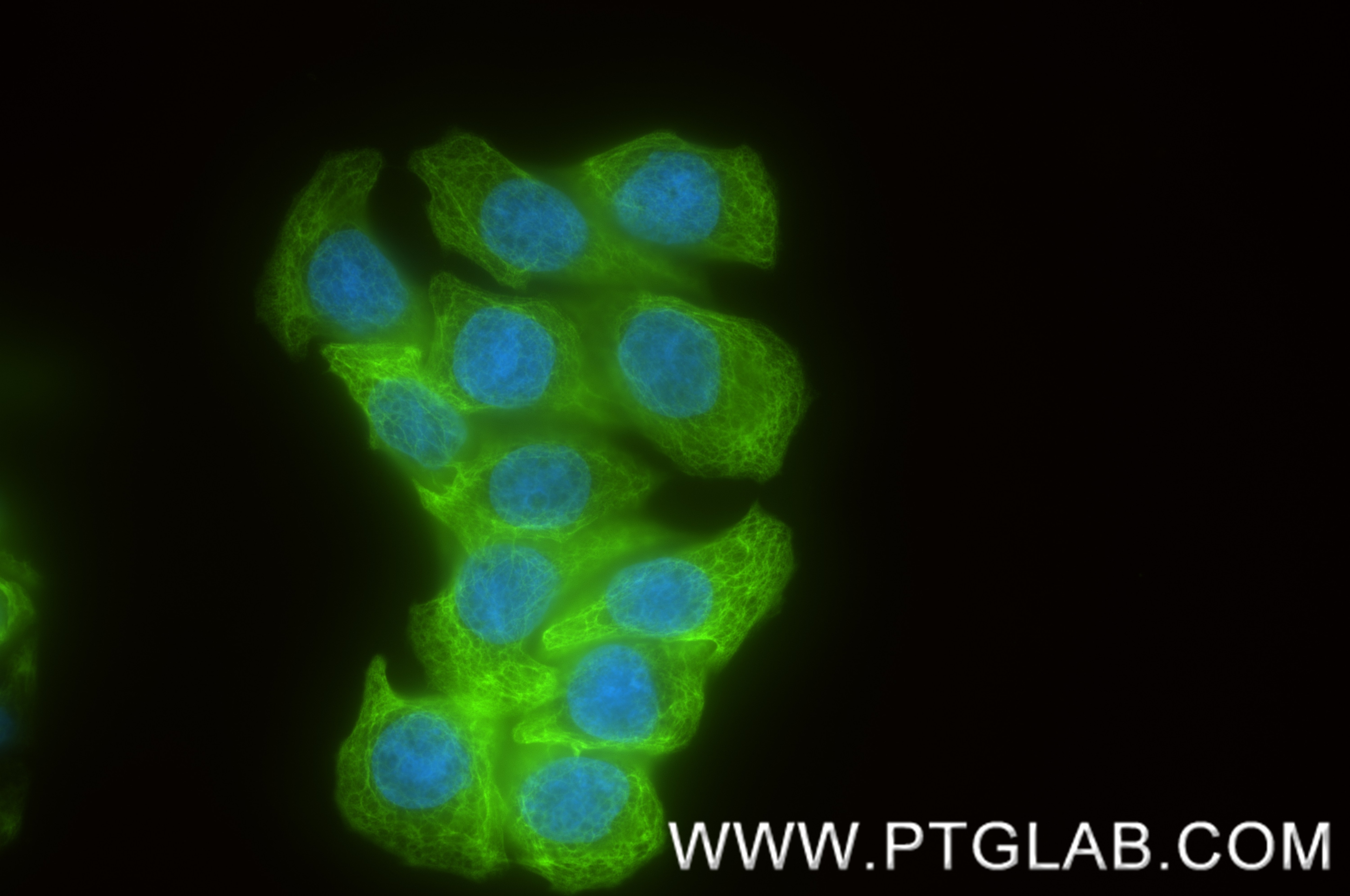 Immunofluorescence (IF) / fluorescent staining of HT-29 cells using Cytokeratin 20 Recombinant monoclonal antibody (82428-1-RR)