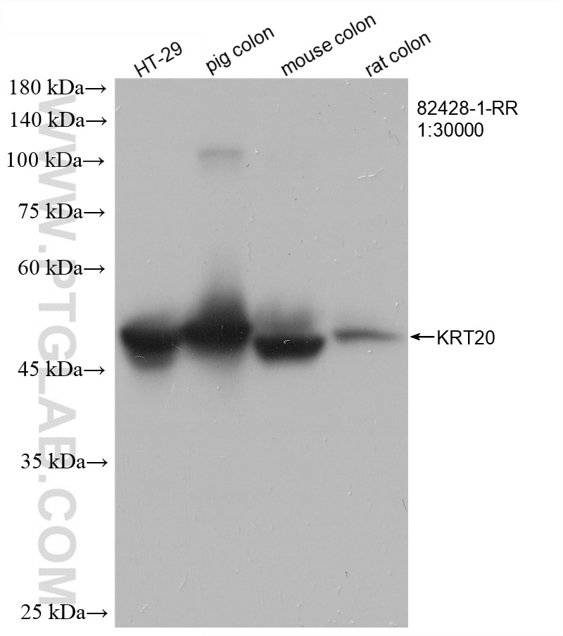 Western Blot (WB) analysis of various lysates using Cytokeratin 20 Recombinant antibody (82428-1-RR)