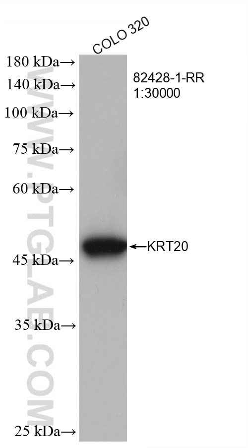 Western Blot (WB) analysis of COLO 320 cells using Cytokeratin 20 Recombinant antibody (82428-1-RR)