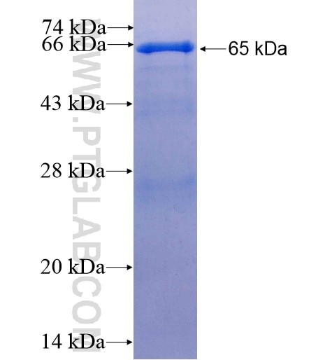KRT20 fusion protein Ag11308 SDS-PAGE