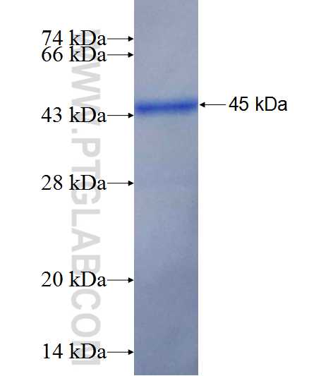 KRT20 fusion protein Ag11336 SDS-PAGE