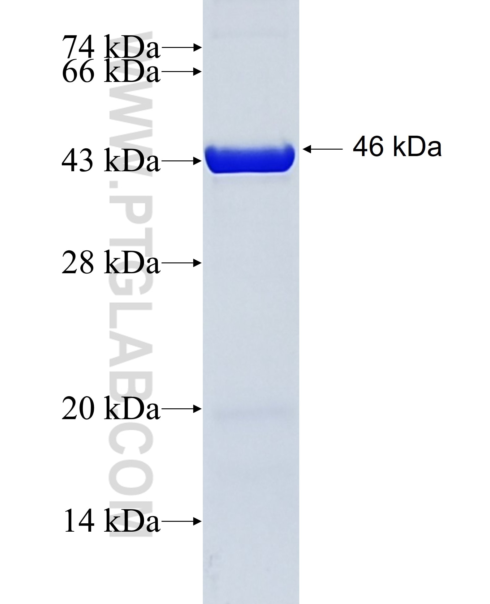 KRT20 fusion protein Ag11336 SDS-PAGE