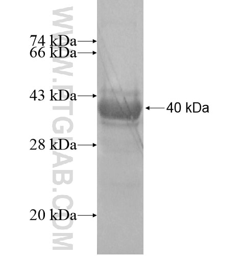 KRT222P fusion protein Ag15472 SDS-PAGE