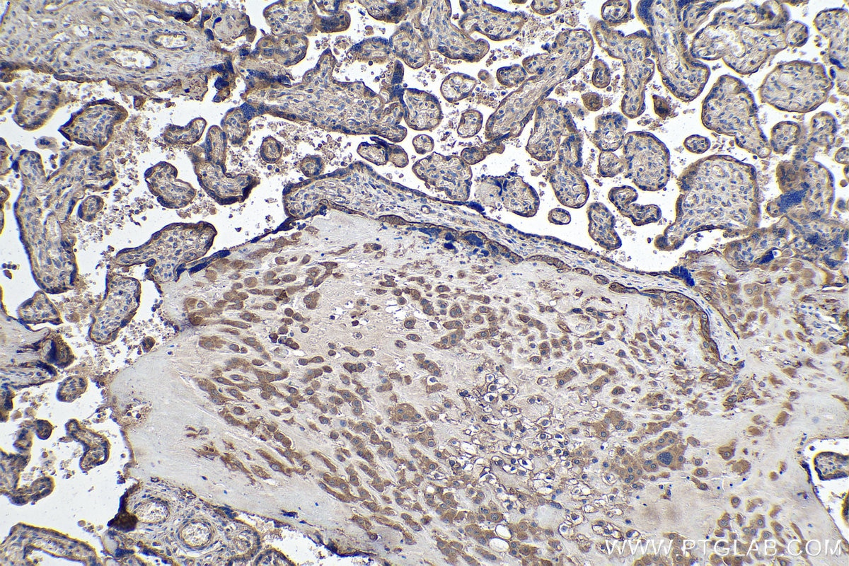 Immunohistochemistry (IHC) staining of human placenta tissue using KRT23 Polyclonal antibody (24049-1-AP)