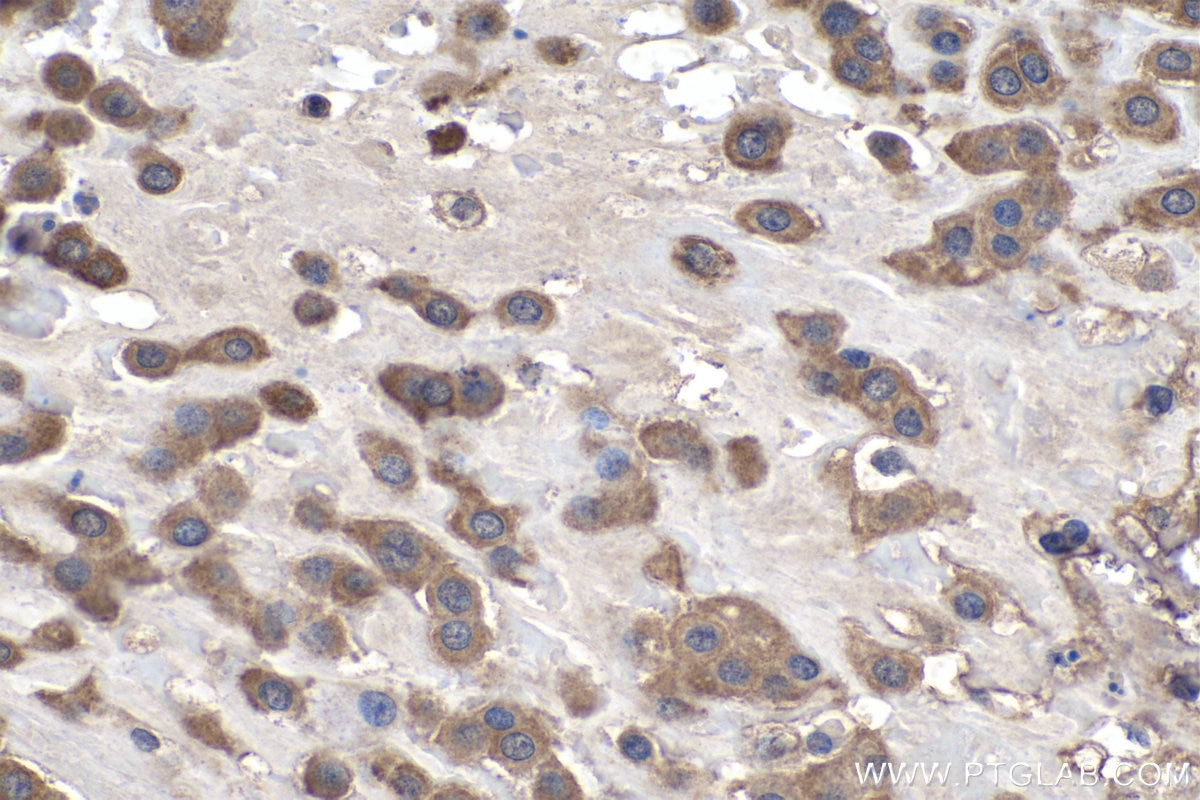 Immunohistochemistry (IHC) staining of human placenta tissue using KRT23 Polyclonal antibody (24049-1-AP)