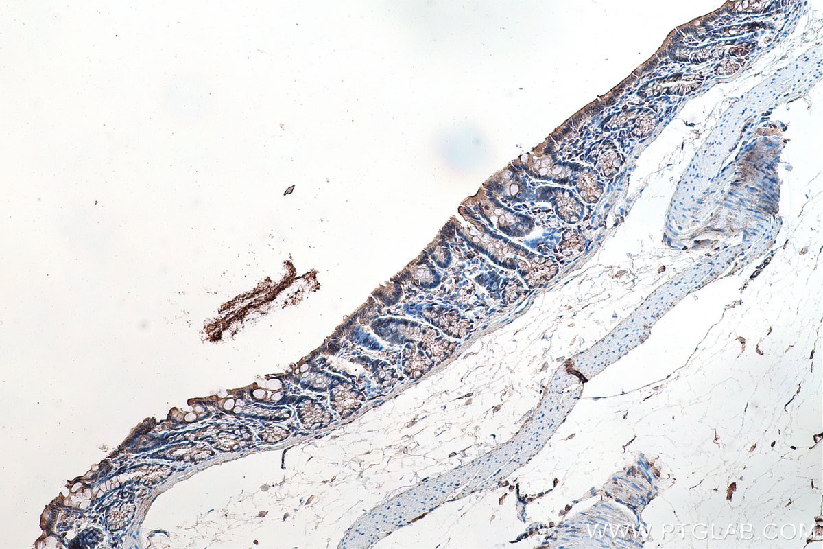 Immunohistochemistry (IHC) staining of rat colon tissue using KRT23 Polyclonal antibody (24049-1-AP)