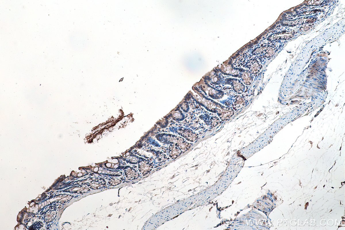 IHC staining of rat colon using 24049-1-AP