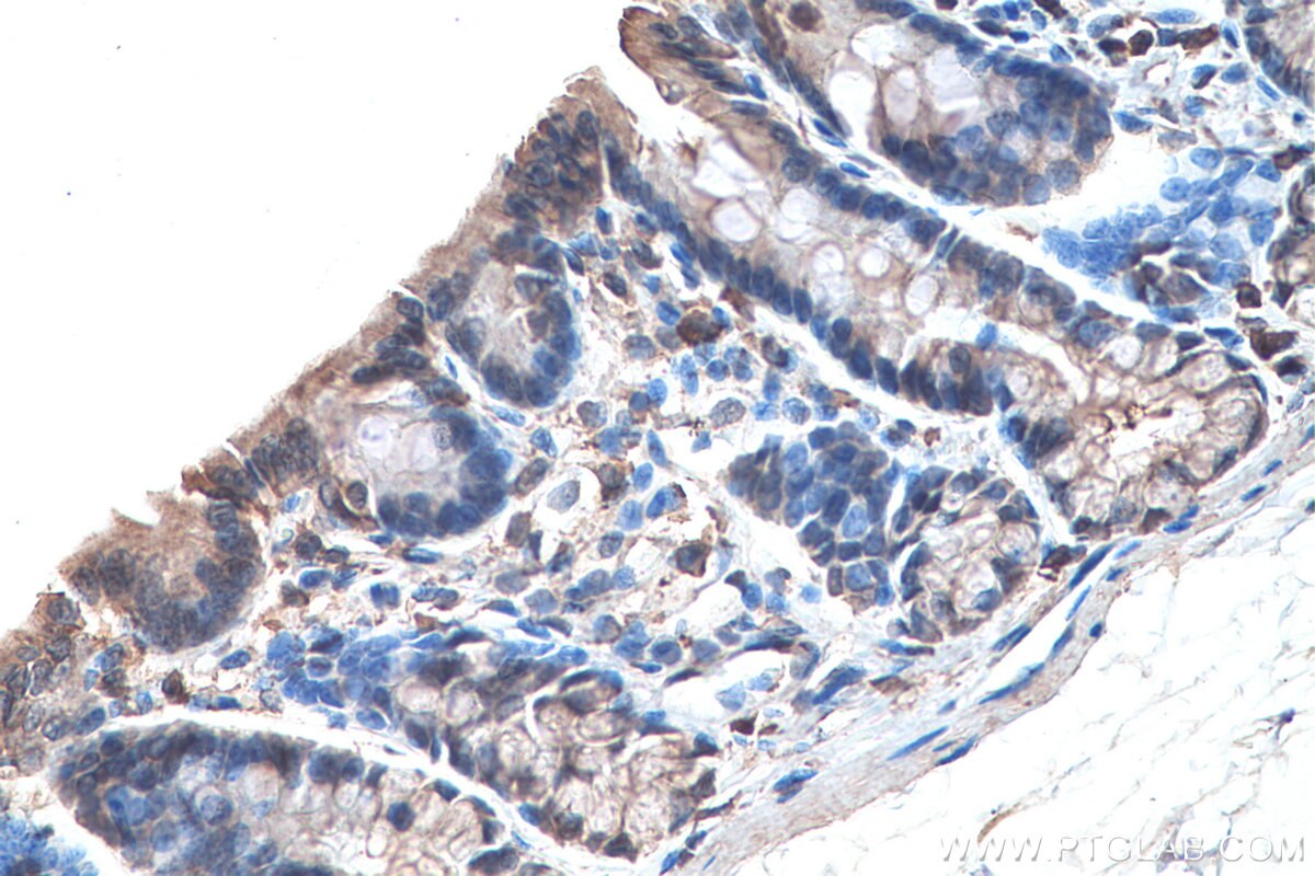 Immunohistochemistry (IHC) staining of rat colon tissue using KRT23 Polyclonal antibody (24049-1-AP)