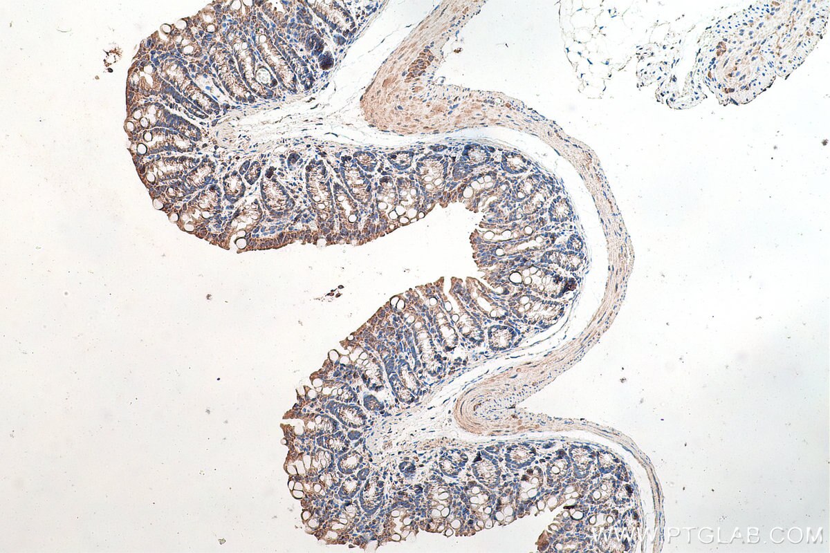 Immunohistochemistry (IHC) staining of mouse colon tissue using KRT23 Polyclonal antibody (24049-1-AP)