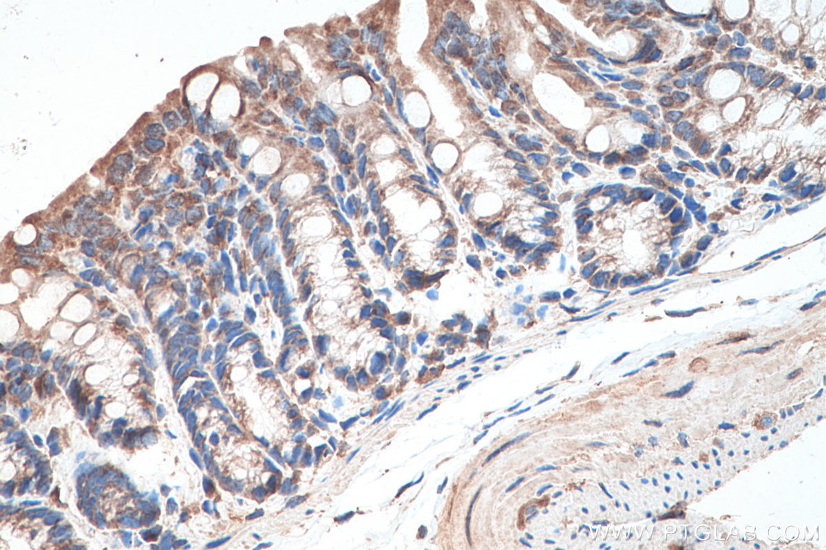 Immunohistochemistry (IHC) staining of mouse colon tissue using KRT23 Polyclonal antibody (24049-1-AP)