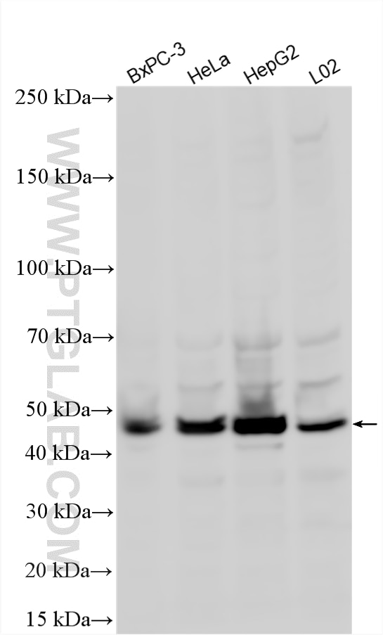 WB analysis using 24049-1-AP Western Blot (WB) analysis of various lysates using Cytokeratin 23 Polyclonal antibody (24049-1-AP)