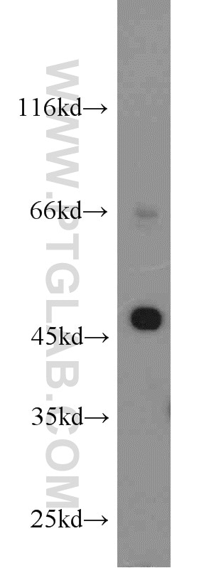 Western Blot (WB) analysis of HeLa cells using KRT23 Polyclonal antibody (24049-1-AP)