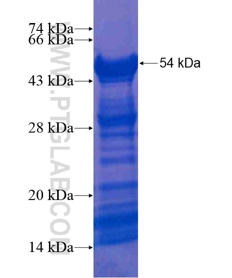 KRT23 fusion protein Ag21129 SDS-PAGE
