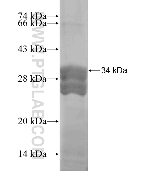 KRT25 fusion protein Ag18926 SDS-PAGE
