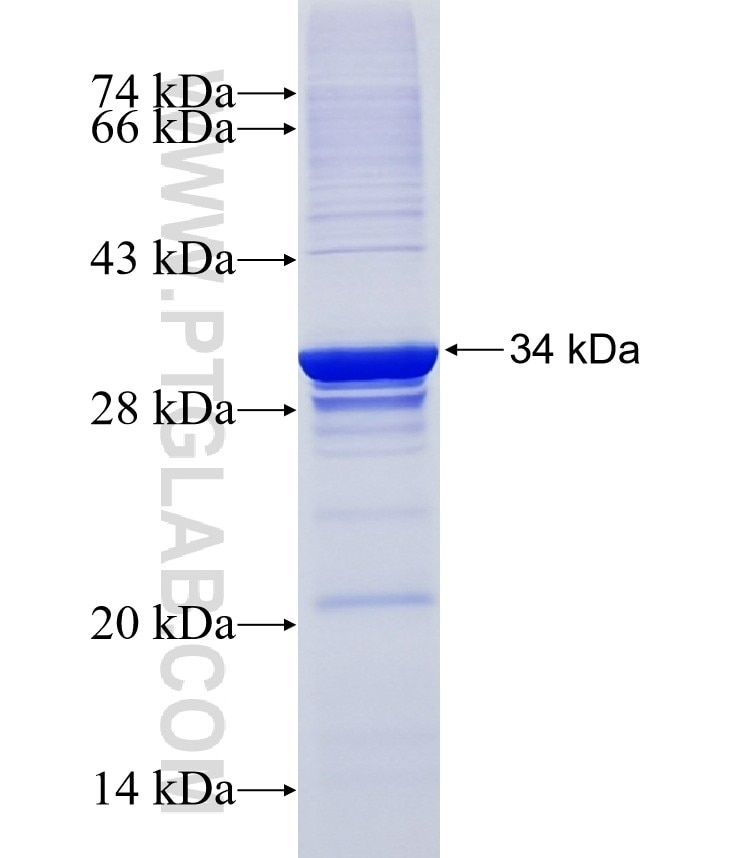 KRT25 fusion protein Ag18926 SDS-PAGE