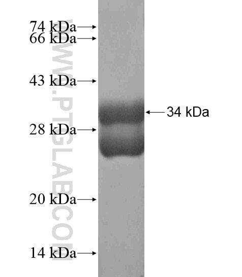 KRT28 fusion protein Ag18932 SDS-PAGE
