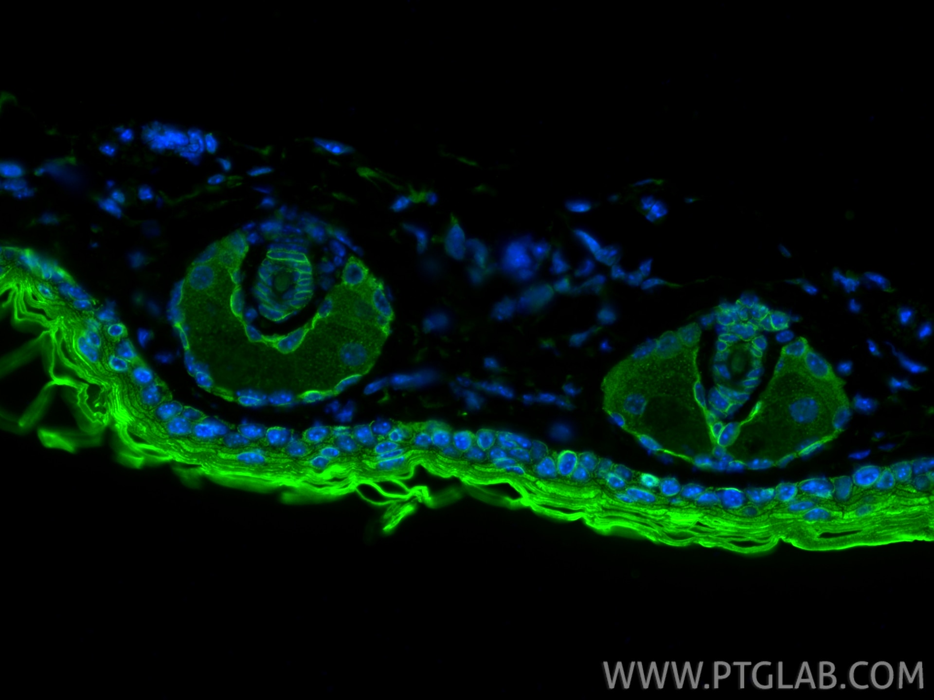 IF Staining of mouse skin using 16850-1-AP Immunofluorescence (IF) / fluorescent staining of mouse skin tissue using Cytokeratin 3 Polyclonal antibody (16850-1-AP)