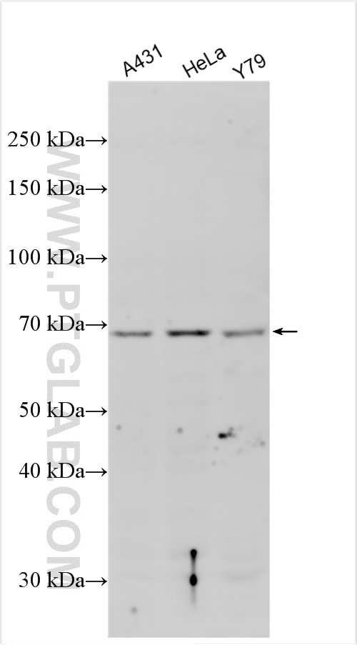 Western Blot (WB) analysis of various lysates using Cytokeratin 3 Polyclonal antibody (16850-1-AP)