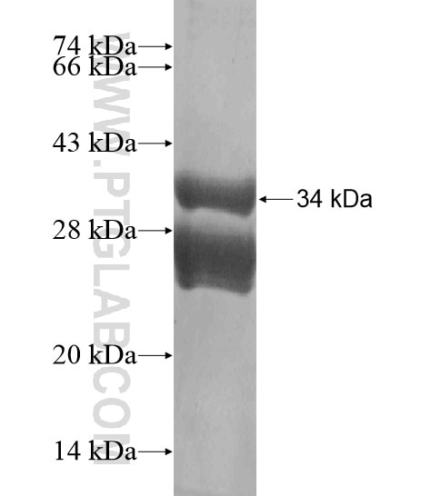 KRT32 fusion protein Ag20165 SDS-PAGE