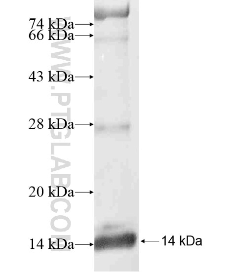KRT32 fusion protein Ag20204 SDS-PAGE