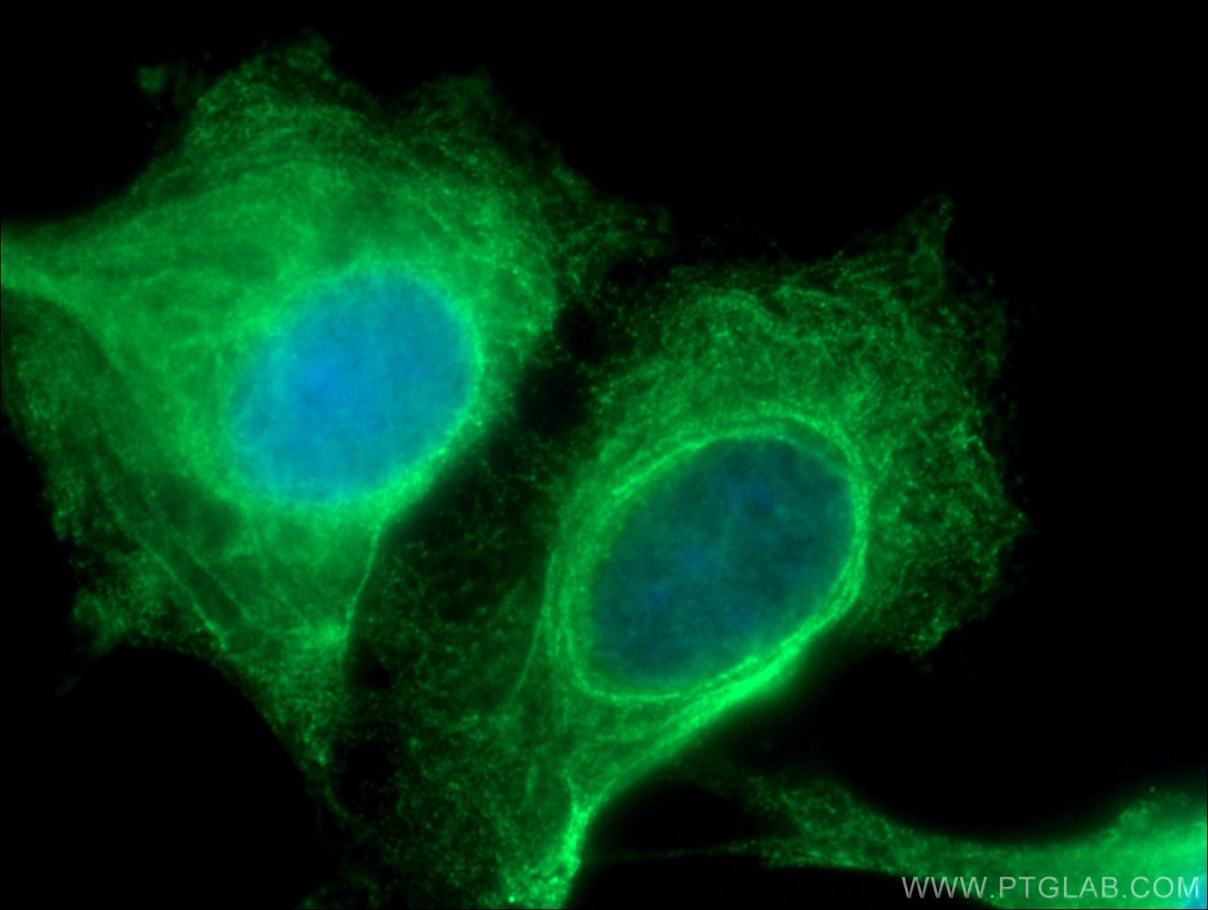 Immunofluorescence (IF) / fluorescent staining of MCF-7 cells using KRT33B Polyclonal antibody (11048-1-AP)