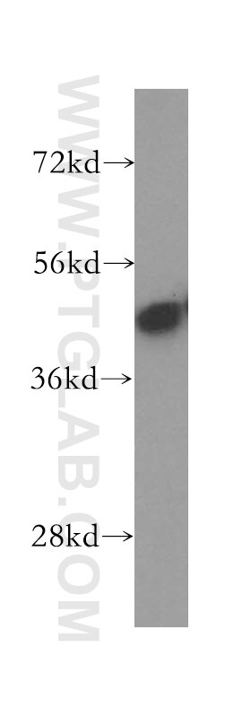 Western Blot (WB) analysis of human brain tissue using KRT33B Polyclonal antibody (11048-1-AP)