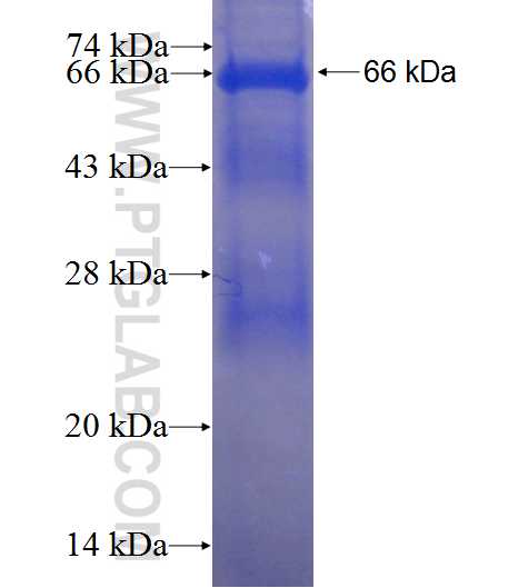 KRT33B fusion protein Ag1522 SDS-PAGE