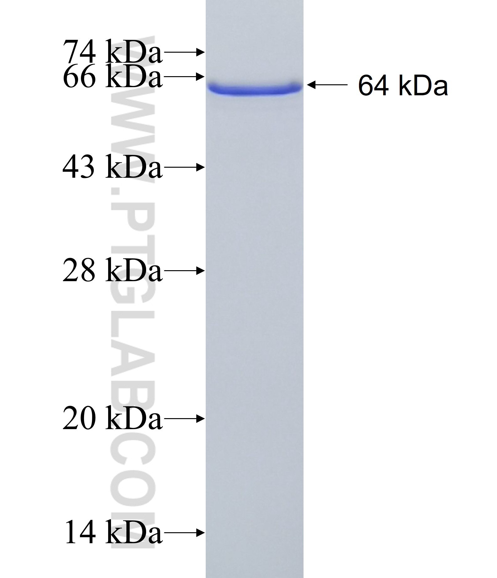 KRT33B fusion protein Ag1522 SDS-PAGE