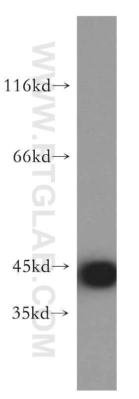 Western Blot (WB) analysis of HepG2 cells using KRT34 Polyclonal antibody (20449-1-AP)