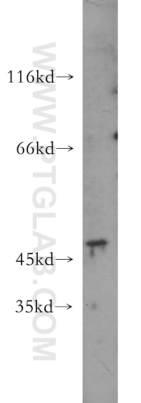 Western Blot (WB) analysis of A375 cells using KRT34 Polyclonal antibody (20449-1-AP)